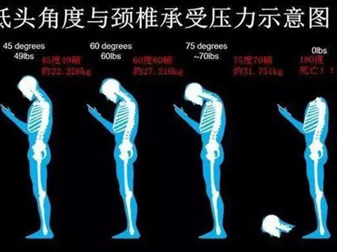 低头角度与颈椎承受压力示意图